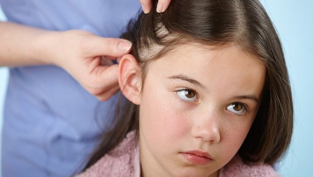 How To Use Tea Tree Oil To Get Rid Of The Blood Sucking Head Lice